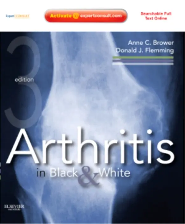 Arthritis in Black and White - Brower, Anne C. (Professor and Chair of Radiology, Eastern Virginia Medical School, Norfolk, Virginia) a Flemming, Donald J. (Vice Chair for Education and Residency Director, Associate Professor of Radiology, G. Victor Rohrer Professor of Radiology Educatio