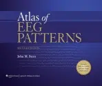 Atlas of EEG Patterns - Stern, John M.