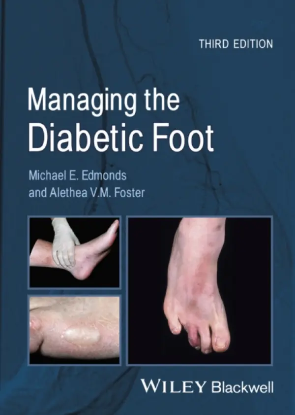 Managing the Diabetic Foot - Edmonds, Michael E. (King's College, University of London, UK) a Foster, Alethea V. M.