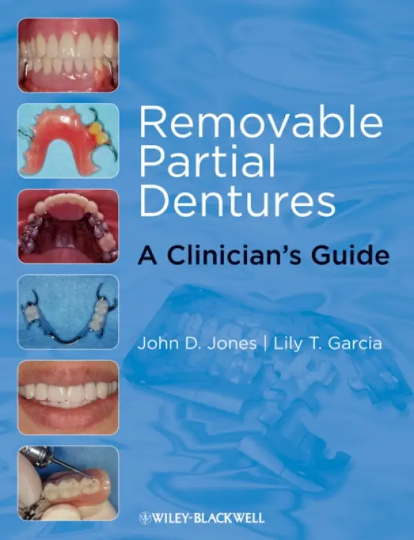 Removable Partial Dentures - Jones, John D. (University of Texas Health Science Center at San Antonio) a Garcia, Lily T. (University of Texas Health Science Center at San Antonio)