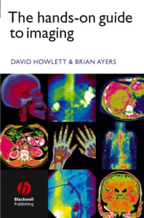 Hands-on Guide to Imaging - Howlett, David C. (Eastbourne General Hospital) a Ayers, Brian