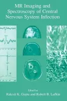 MR Imaging and Spectroscopy of Central Nervous System Infection