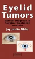 Eyelid Tumors - Older, Jay Justin (University of South Florida, College of Medicine, Tampa, Florida, USA)
