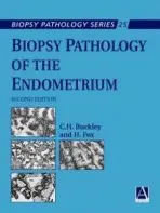 Biopsy Pathology of the Endometrium, 2Ed - Buckley, Hilary a Fox, Harold