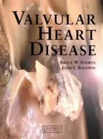 Valvular Heart Disease - Andrus, Bruce a Baldwin, John