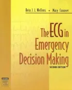 ECG in Emergency Decision Making - Wellens, Hein J. J., MD, PhD (Professor of Cardiology, University of Maastricht a Chairman, Department of Cardiology, University Hospital Maastricht a Maastricht, The Netherlands) a Conover, Mary Boudreau (Educational Director, Critical Care Conferences, Sant