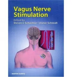 Vagus Nerve Stimulation
