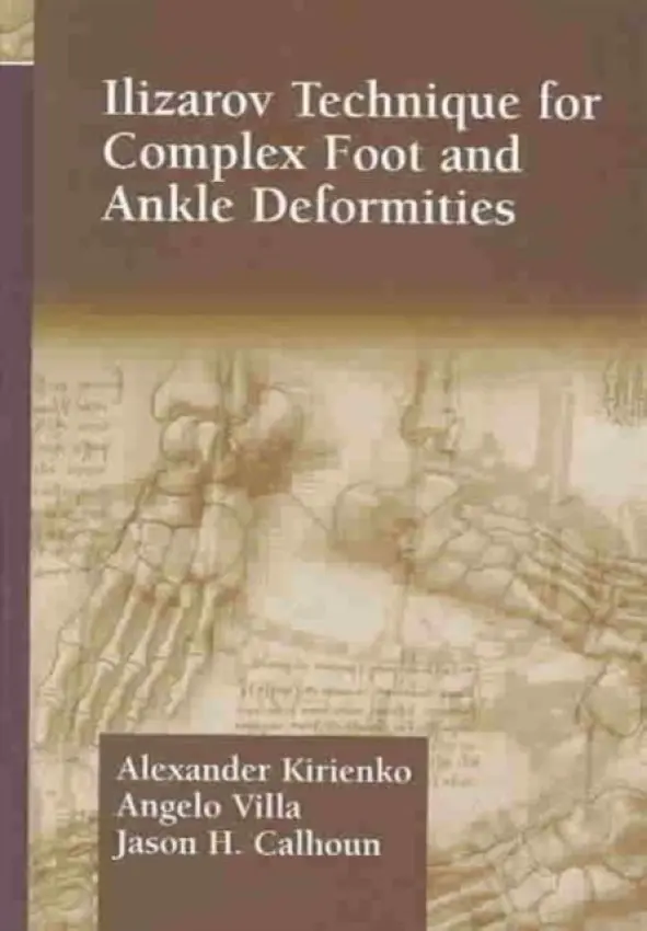 Ilizarov Technique for Complex Foot and Ankle Deformities - Kirienko, Alexander a Villa, Angelo a Calhoun, Jason H.