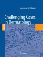 Challenging Cases in Dermatology - El-Darouti, Mohammad Ali