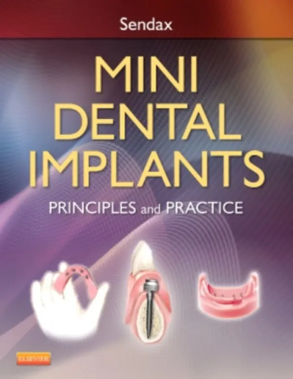 Mini Dental Implants - Sendax, Victor Dr.