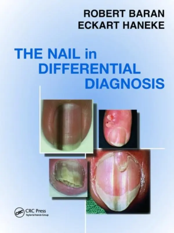 Nail in Differential Diagnosis - Baran, Robert a Haneke, Eckart