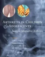 Arthritis in Children and Adolescents