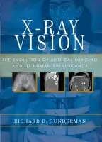 X-Ray Vision - Gunderman, Richard B. (Professor of Radiology, Pediatrics, Medical Education, Philosophy, Liberal Arts, and Philanthropy, Professor of Radiology, Pediatrics, Medical Education, Philosophy, Liberal Arts, and Philanthropy, Indiana University, Indianapolis,