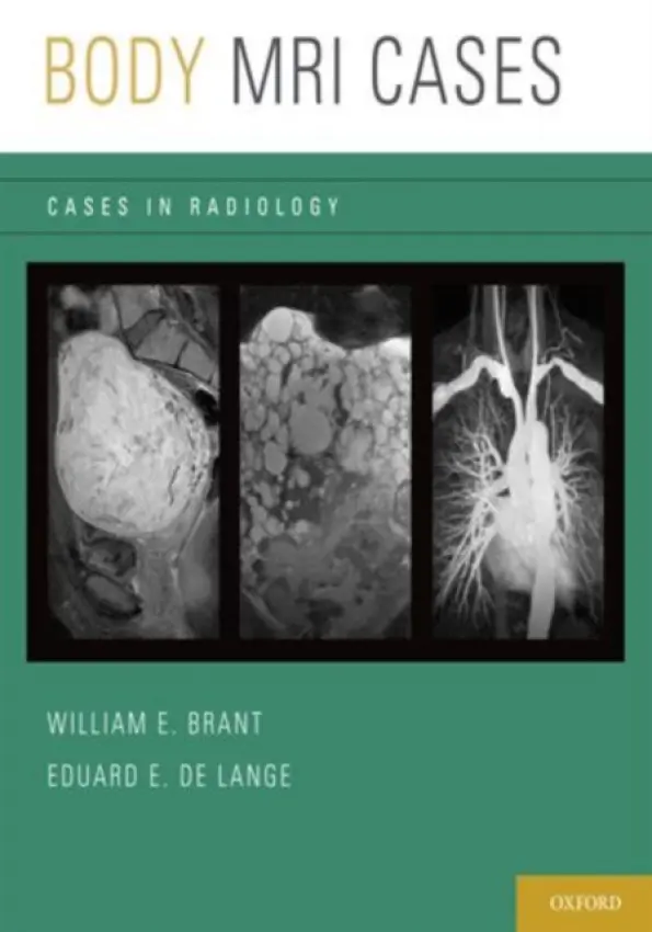 Body MRI Cases - de Lange, Eduard E. (Professor of Radiology, Professor of Radiology, University of Virginia, Charlottesville, VA, USA)