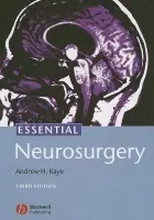 Essential Neurosurgery - Kaye, Andrew H. (University of Melbourne, Melbourne, Australia)