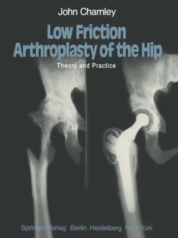 Low Friction Arthroplasty of the Hip - Charnley, J.