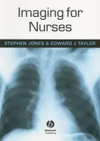 Imaging for Nurses - Jones, Stephen (Formerly Leeds Teaching Hospital NHS Trust) a Taylor, Edward (Radiographer)