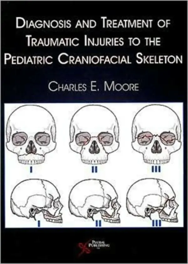 Diagnosis and Treatment of Traumatic Injuries to the Pediatric Craniofacial Skeleton - Moore, Charles E.