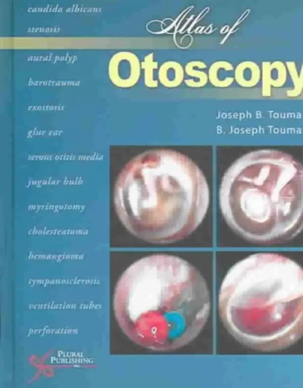 Atlas of Otoscopy - Touma, Joseph B. a Touma, B. Joseph