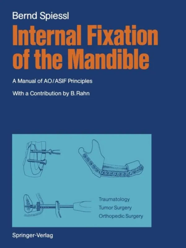 Internal Fixation of the Mandible - Spiessl, Bernd