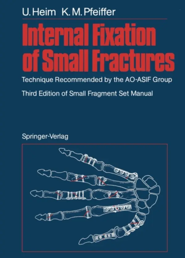 Internal Fixation of Small Fractures - Heim, Urs a Pfeiffer, Karl M.