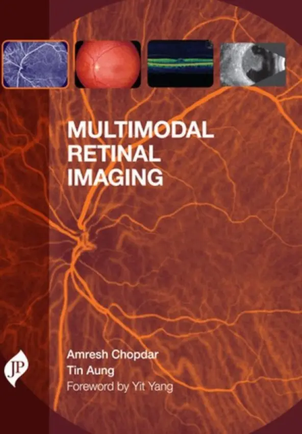 Multimodal Retinal Imaging - Chopdar, Amresh a Aung, Tin