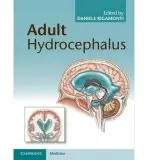 Adult Hydrocephalus