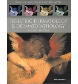 Pediatric Dermatology and Dermatopathology - Caputo, Ruggero a Gelmetti, Carlo