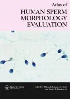 Atlas of Human Sperm Morphology Evaluation