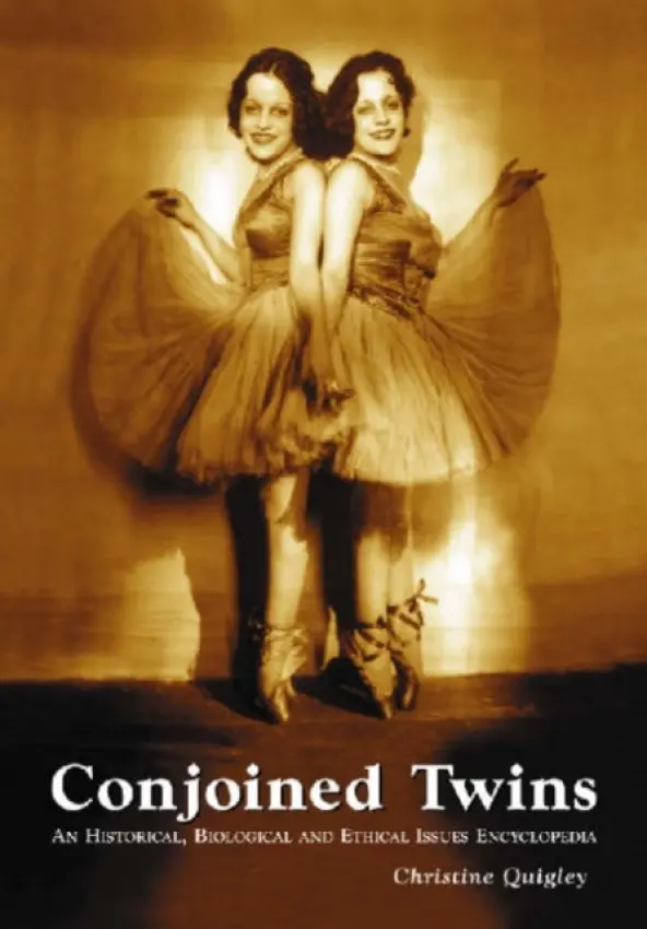 Conjoined Twins - Quigley, Christine