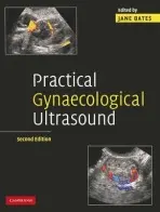 Practical Gynaecological Ultrasound