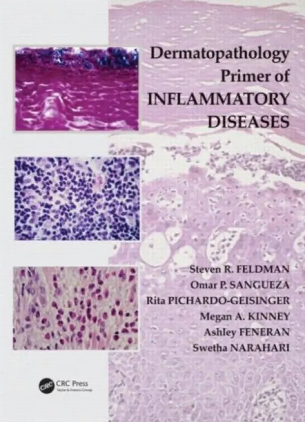 Dermatopathology Primer of Inflammatory Diseases - Feldman, Steven R. a Sangueza, Omar P. a Pichardo-Geisinger, Rita a Kinney, Megan a Feneran, Ashley a Narahari, Swetha