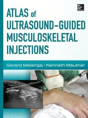 Atlas of Ultrasound-Guided Musculoskeletal Injections - Malanga, Gerard a Mautner, Kenneth