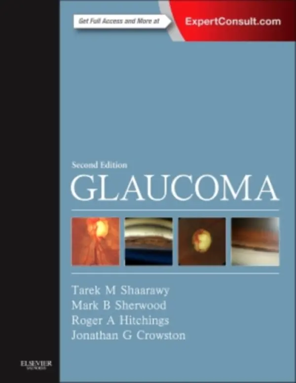 Glaucoma - Shaarawy, Tarek M. (Privat Docent, University of Geneva a  Consultant Ophthalmologist and Head, Glaucoma Sector, Ophthalmology Service, Department of Clinical Neurosciences, Geneva University Hospitals, Geneva, Switzerland) a Sherwood, Mark B. (Daniels Profes