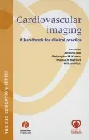 Cardiovascular Imaging