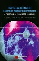 12 Lead ECG in ST Elevation Myocardial Infarction - Bayes de Luna, Antoni (Hospital Santa Creu i Sant Pau, Barcelona, Spain) a Fiol-Sala, Miquel (Hospital Son Dureta, Palma, Mallorca, Spain) a Antman, Elliot M. (Harvard Medical School)
