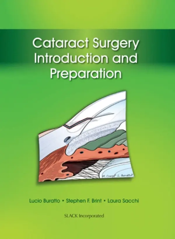 Cataract Surgery - Buratto, Lucio a Brint, Stephen a Sacchi, Laura