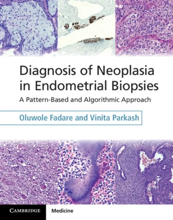 Diagnosis of Neoplasia in Endometrial Biopsies Book and Online Bundle - Fadare, Oluwole (Vanderbilt University, Tennessee) a Parkash, Vinita (Yale University, Connecticut)