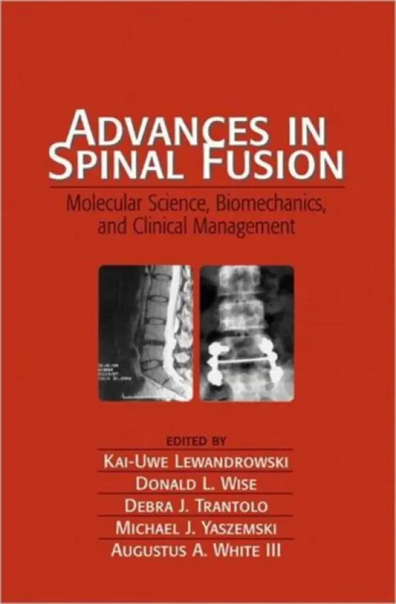 Advances in Spinal Fusion - Lewandrowski, Kai-Uwe
