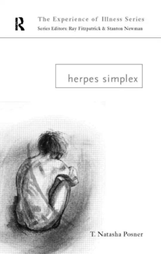 Herpes Simplex - Posner, T. Natasha