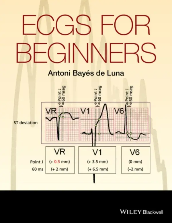ECGs for Beginners - Bayes de Luna, Antoni (Emeritus Professor of Cardiology, Autonomous University of Barcelona, Senior Investigator, Institut Catala Ciencies Cardiovasculars, Hospital Sant Pau, Senior Consultant, Hospital Quiron, Barcelona, Spain)