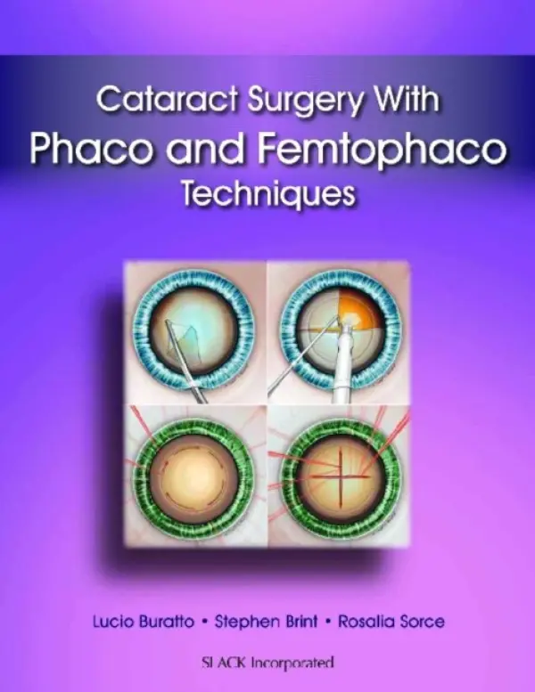Cataract Surgery With Phaco and Femtophaco Techniques - Buratto, Lucio a Brint, Stephen a Sorce, Rosalia