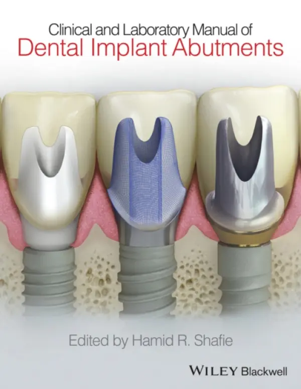 Clinical and Laboratory Manual of Dental Implant Abutments - Shafie, Hamid R. (President, American Institute of Implant Dentistry, Washington, DC, USA)