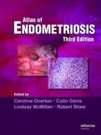 Atlas of Endometriosis - Overton, Caroline (St Michael’s Hospital and Bristol Royal Infirmary, Bristol, UK) a Shaw, Robert W. (Derby City General Hospital, Derby, UK) a McMillan, Lindsay (Portland Hospital, London, UK) a Davis, Colin (St Bartholomew's Hospital, London, UK)