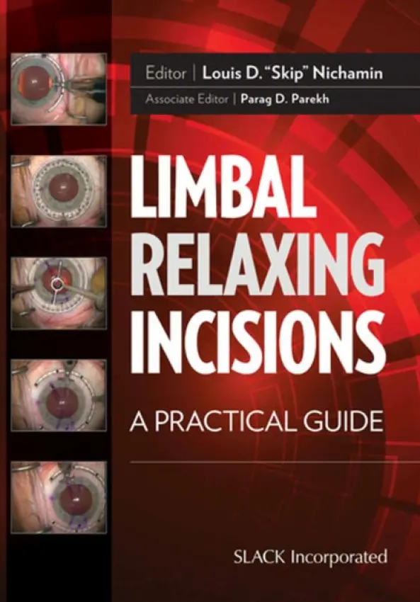 Limbal Relaxing Incisions - Nichamin, Louis