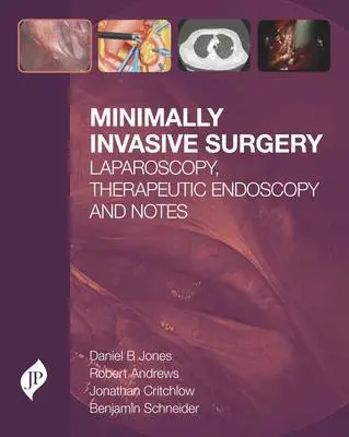 Minimally Invasive Surgery - Jones, Daniel  B a Andrews, Robert a Critchlow, Jonathan F a Schneider, Benjamin E