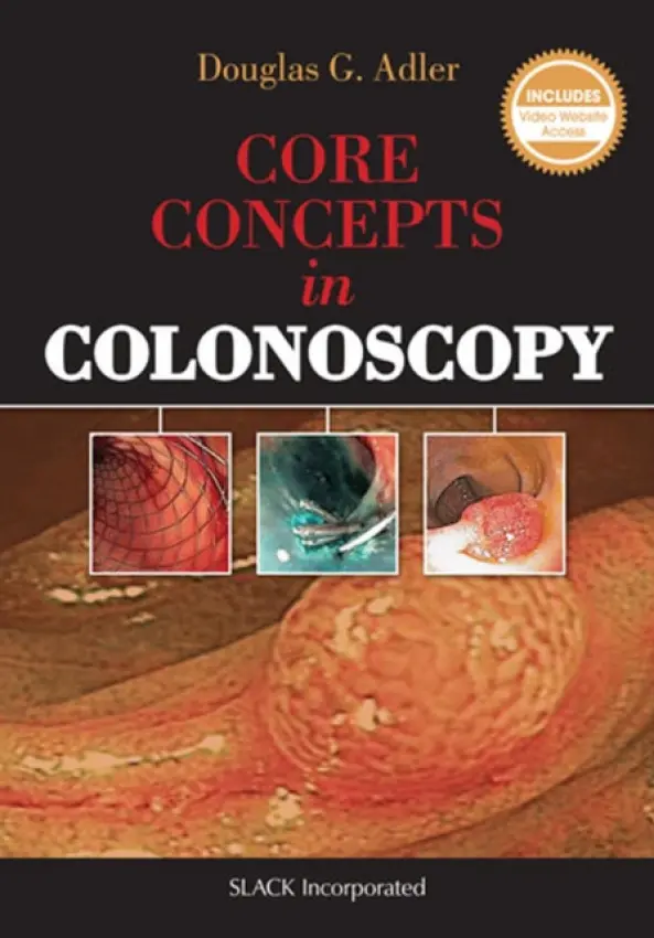 Core Concepts in Colonoscopy - Adler, Douglas