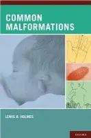 Common Malformations - Holmes, Lewis B. (Professor of Pediatrics, Professor of Pediatrics, Harvard Medical School, USA, Boston, MA)