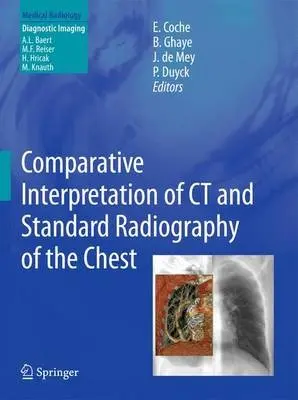 Comparative Interpretation of CT and Standard Radiography of the Chest