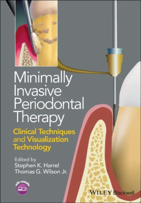 Minimally Invasive Periodontal Therapy - Harrel, Stephen K. (University of Texas at San Antonio Dental School, San Antonio, Texas, USA) a Wilson, Thomas G. (President of Texas Medical and Dental Designs LLC, Dallas, Texas, USA)